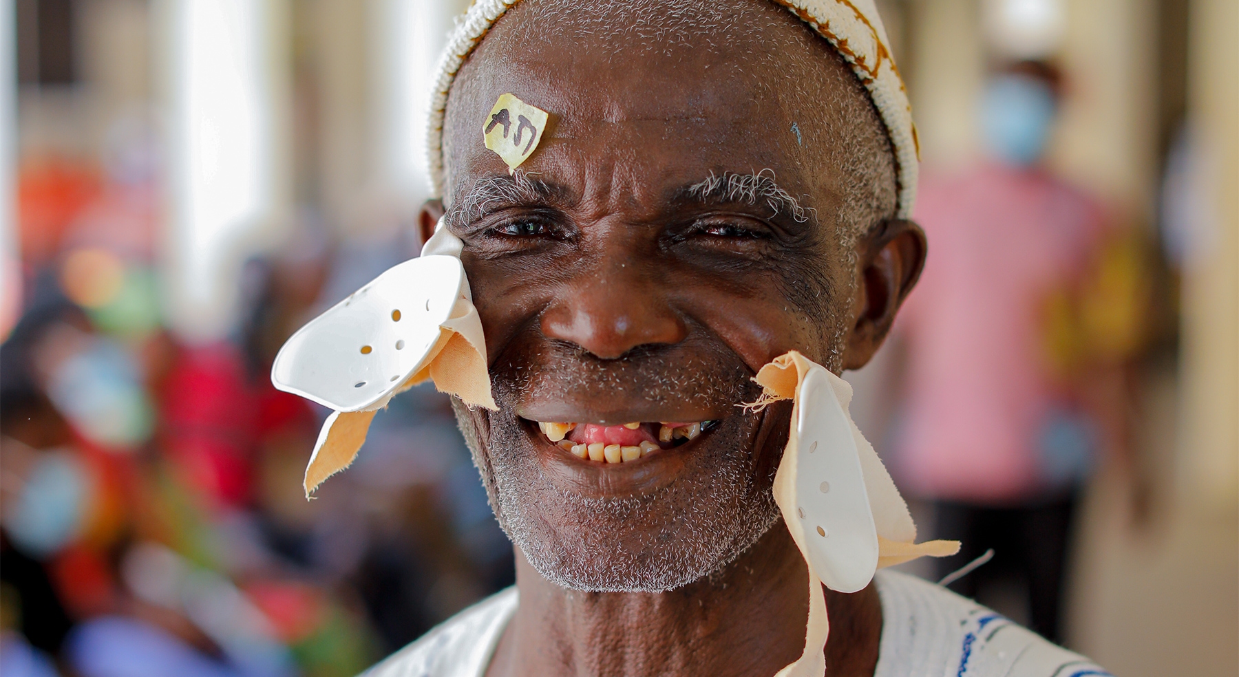 Cataracts cure blindness project