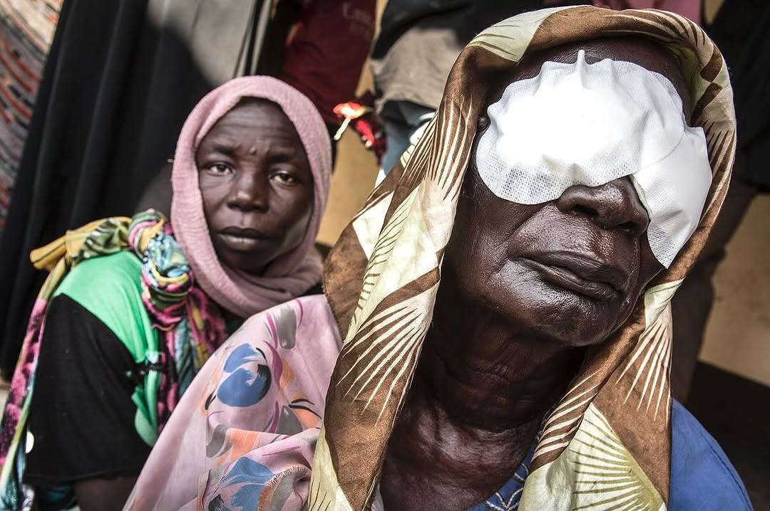 Chris Hildreth photograph of blind patient in South Sudan
