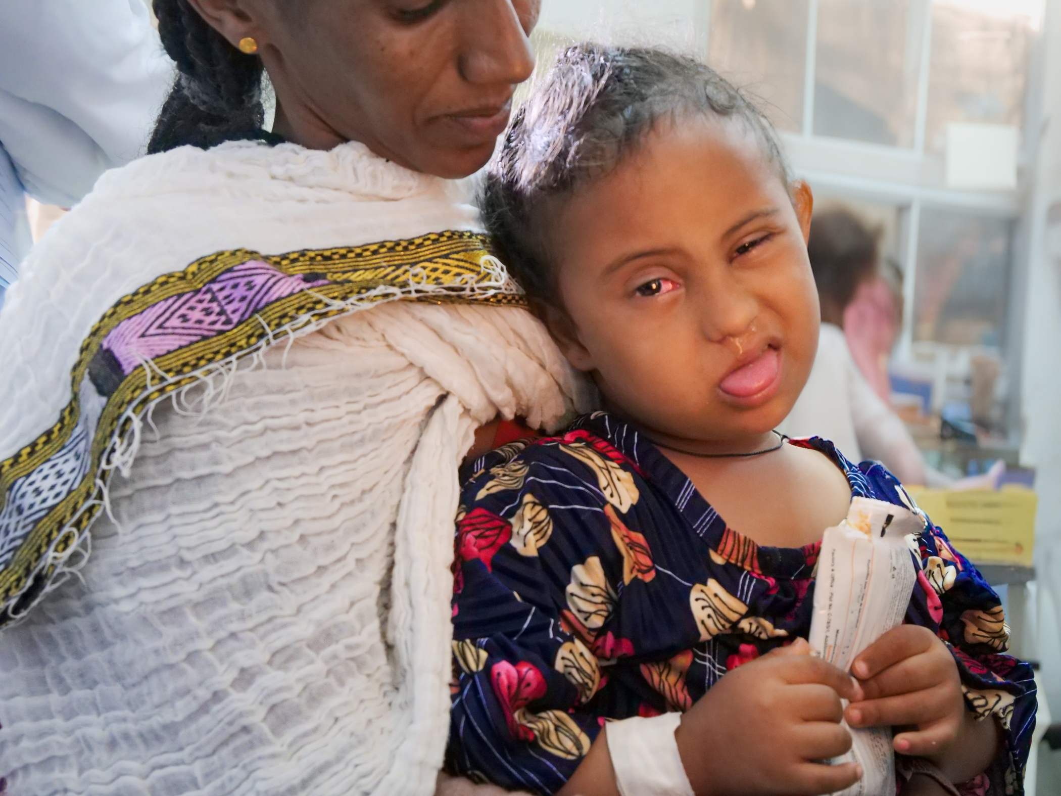 Heran after surgery for strabismus