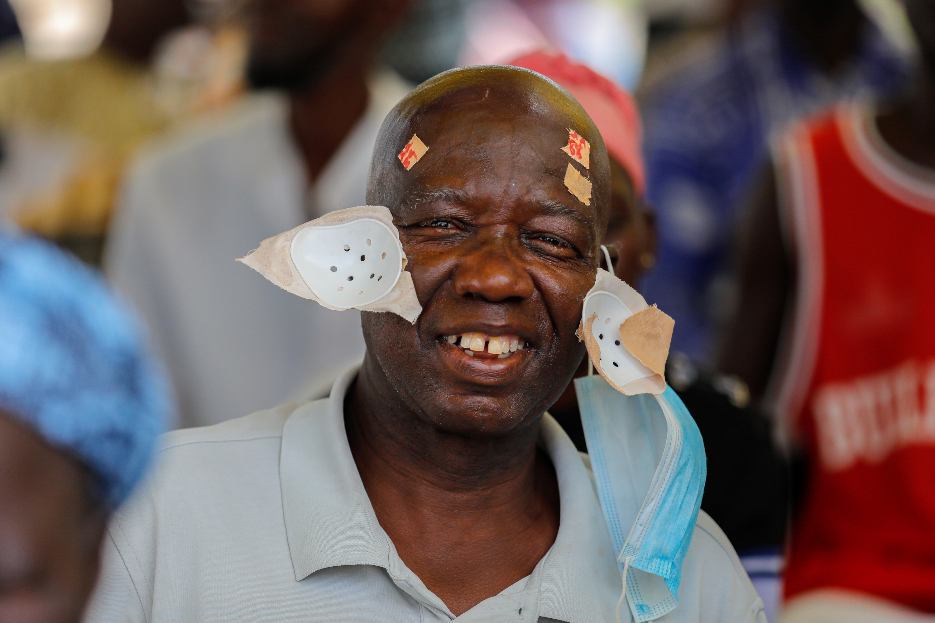 KOKOROKO HCP KOFORIDUA OCTOBER2022 U1 A8081 3000x2000 0df56197 0fdd 4b4f 993d d52f14911a72