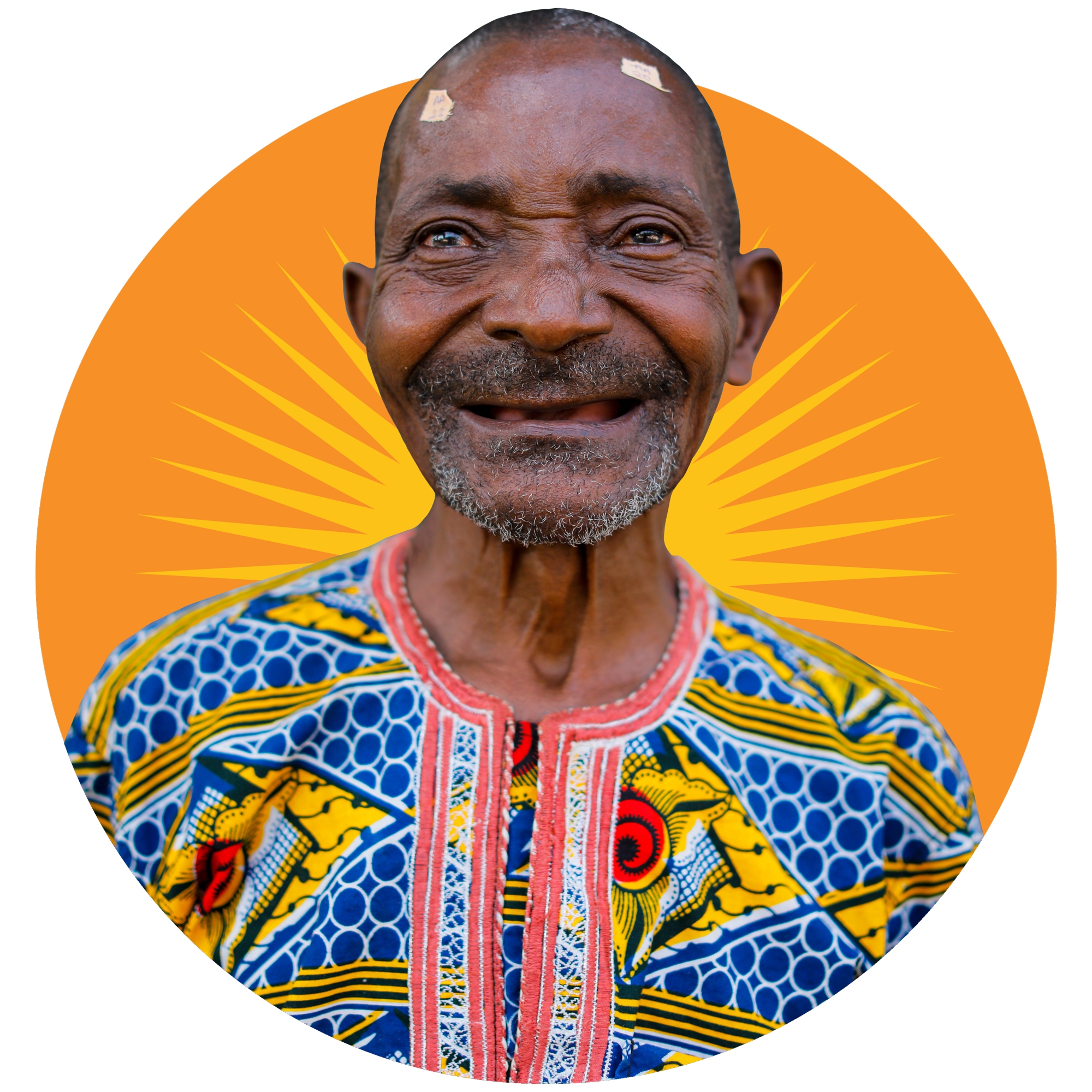 A man smiles after a cataract surgery cures his blindness
