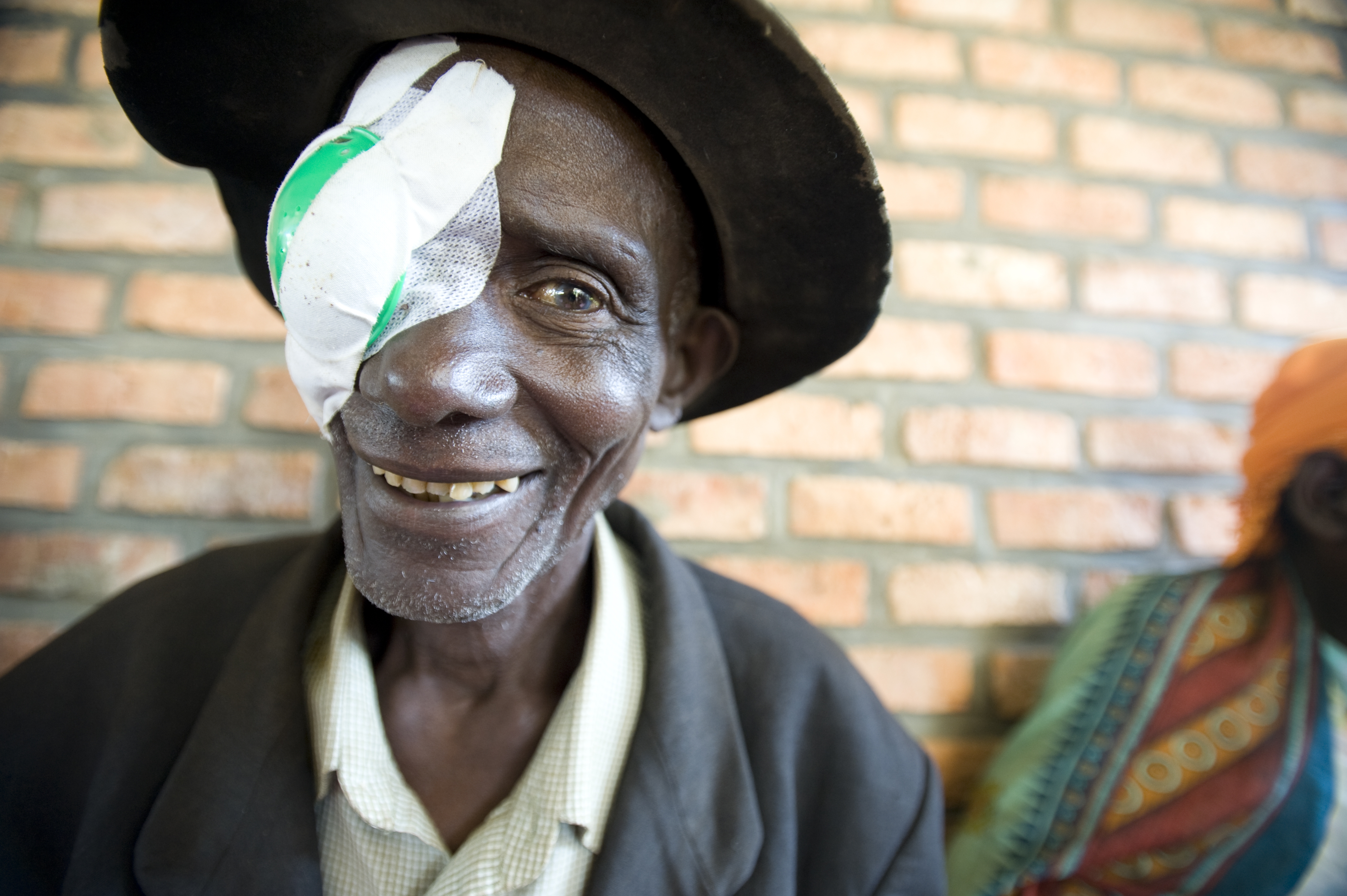 Cure Blindness Project in Rwanda