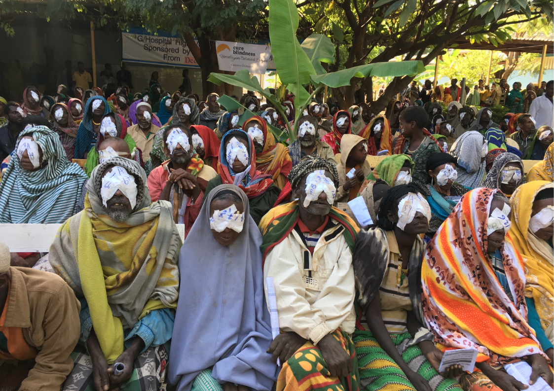High volume cataract surgical outreach in Ethiopia